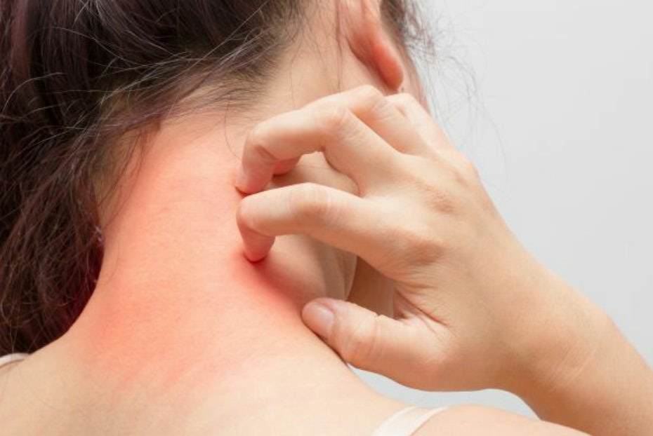Bouton de chaleur Quelles en sont les principales causes