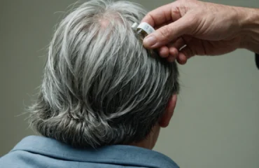 effet bétadine sur cheveux blancs